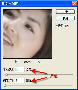 教你去掉MM脸上的雀斑一法