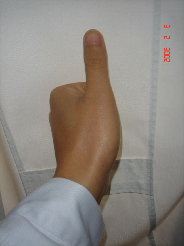 露一小手