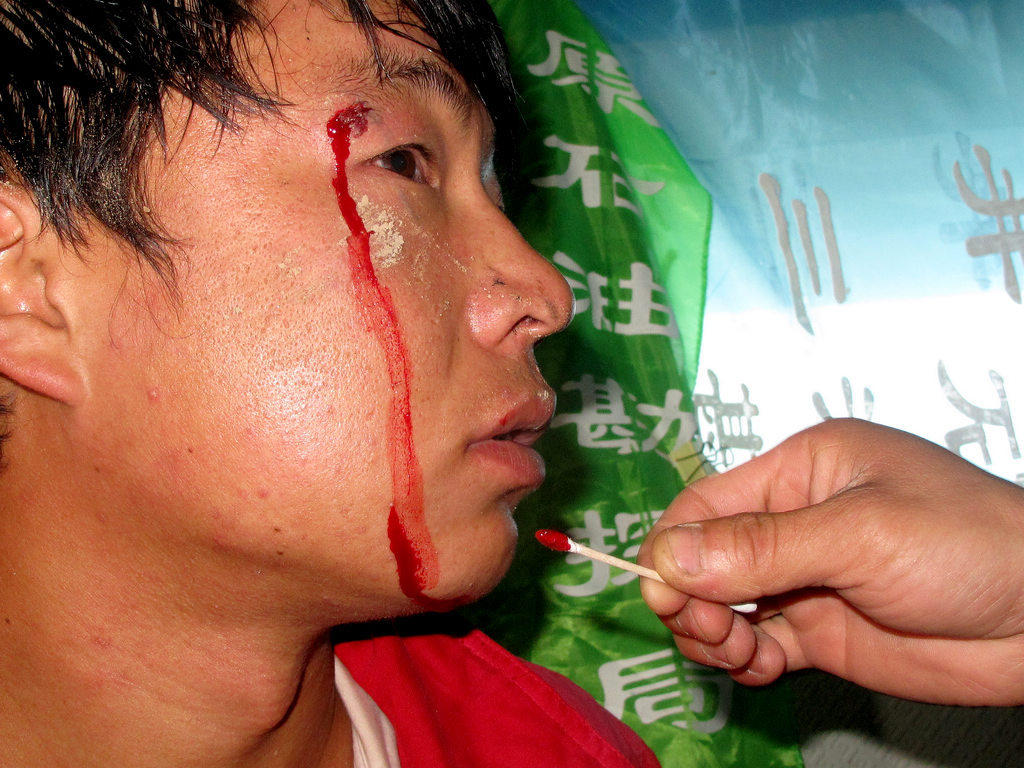 一线工作的艰苦不是身经无法想象也是最可爱的人，应该加以关注！